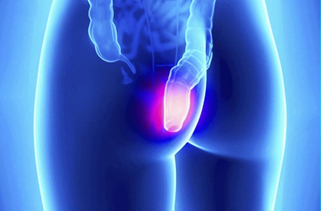 Gelarex var lietot gan ārēji, gan rektāli